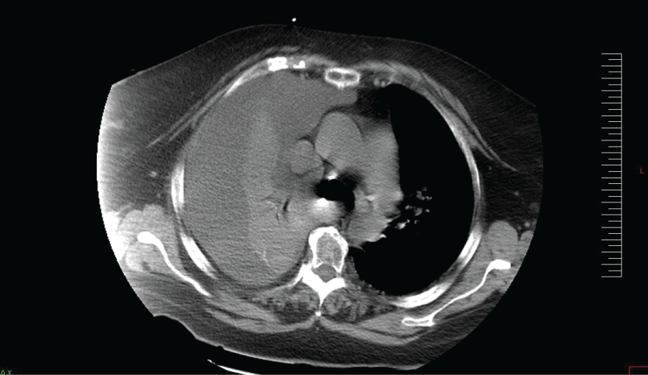 view figure 1