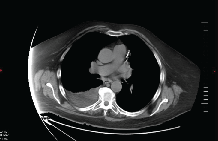view figure 2