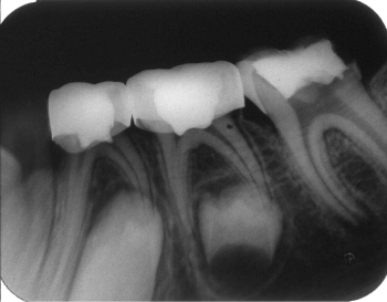 Figure2