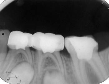 Figure4