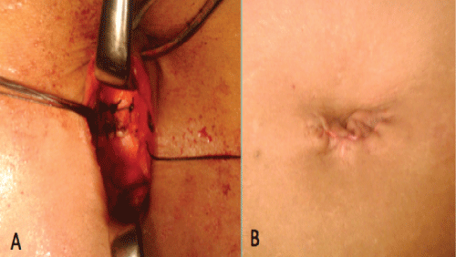 Figure1